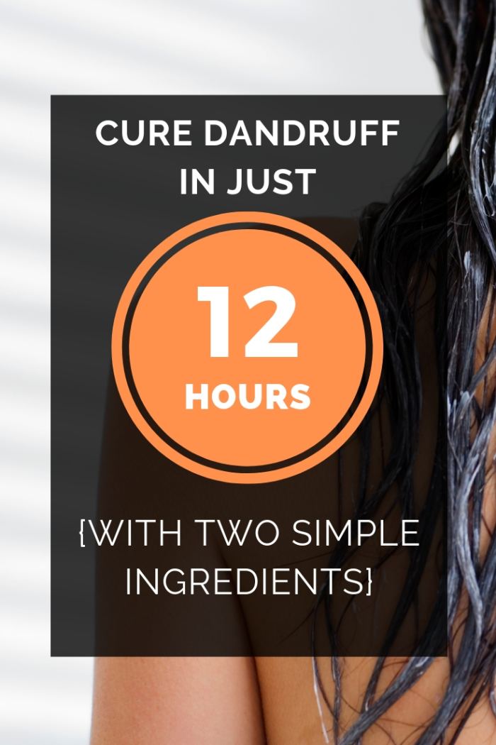 These natural ingredients can provide effective dandruff treatment that will keep your scalp healthy.