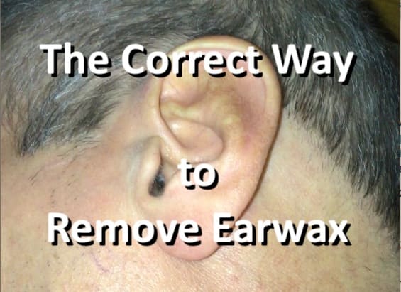 ear wax build up