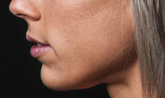The Rio Neck Toner gives great results on a younger person with only a slight sag. I only wish my results were as good, but I have to be realistic!