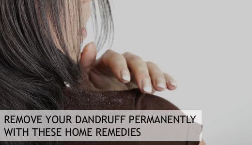 Dandruff is a common skin condition. Its causes are poorly understood, but a number of aggravating factors have been suggested.