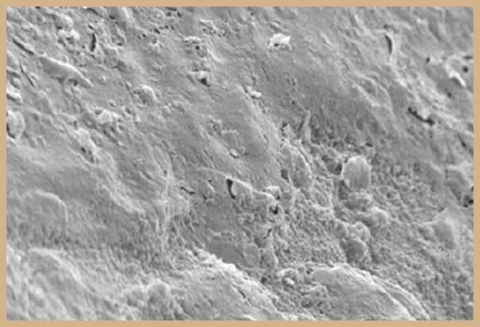 Under a microscope and magnified 5000 times, this image shows plaque accumulation on the glazed side of the fitting surface of a denture after just one month!