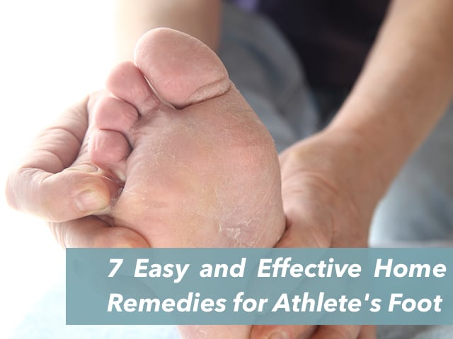 Athlete's foot, in medical term it is called tinea pedis, is an infection caused by fungi that appears between the toes.