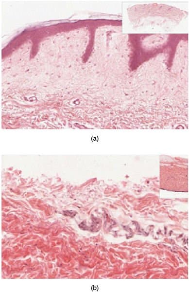These slides show cross-sections of the epidermis and dermis of (a) thin and (b) thick skin. Note the significant difference in the thickness of the epithelial layer of the thick skin. From top, LM × 40, LM × 40. (Micrographs provided by the Regents