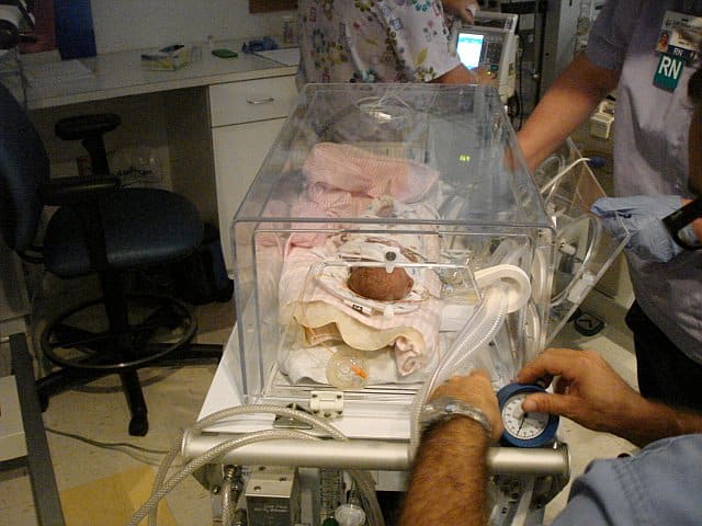 This travel Incubator is used to transport babies between hospitals. This is my daughter being transferred to a different hospital for surgery.
