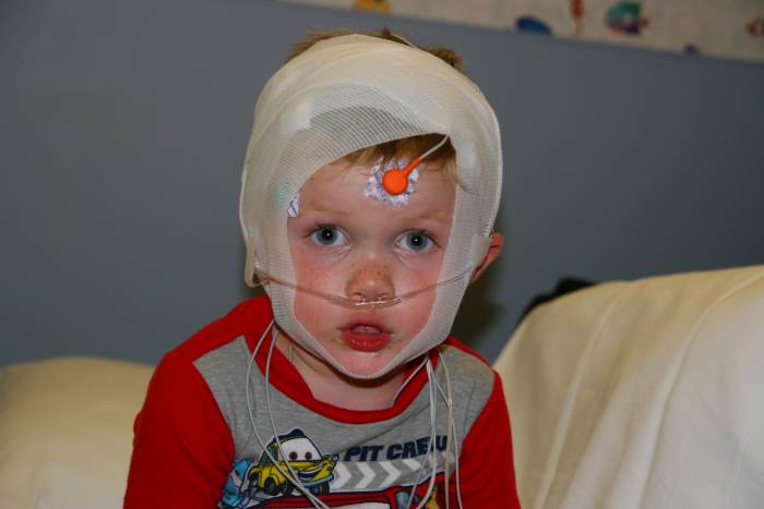 Pediatric Sleep Study: All hooked up and ready for bed. It might be hard to get to sleep with all of this equipment on!