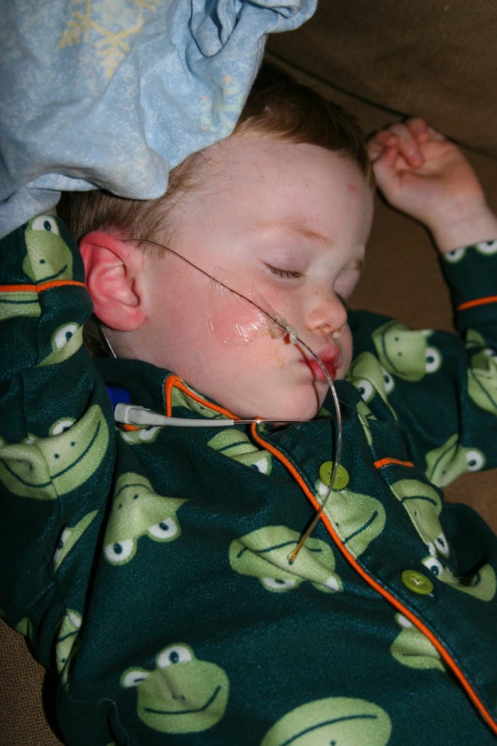 Our son's first airway probe became dislodged at night when the medical tape became wet from a runny nose.