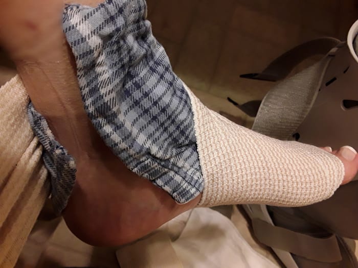 Wrapping is easier if you have someone else to hold poultice in place, but can be done alone. Freezing it helps keep it together while wrapping.