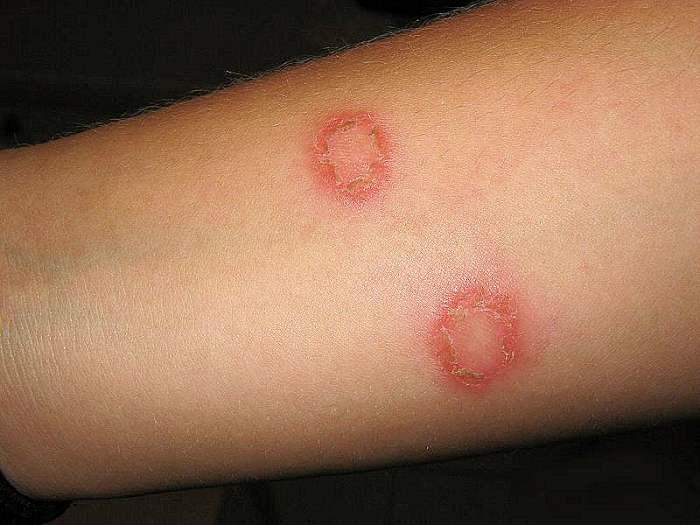 10 Home Remedy Uses for Distilled White Vinegar - RemedyGrove - Holistic Wellness