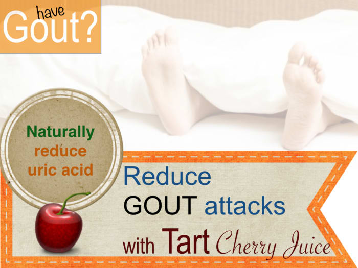 Antioxidant rich tart cherry juice and tart cherries help lower uric acid and prevent attacks. - University of Maryland Medical Center