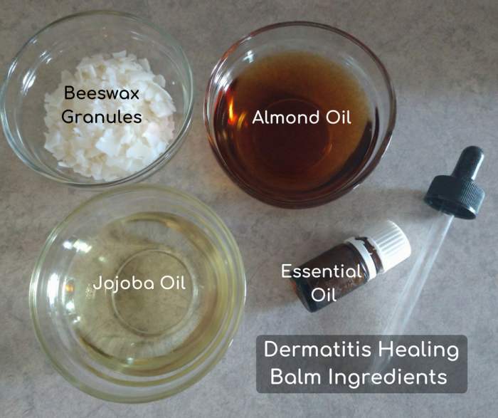 How I Got Rid of Itchy Contact Dermatitis the Natural Way RemedyGrove Holistic Wellness