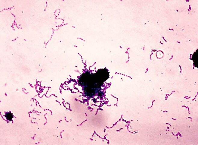 This is a stained slide of Streptococcus mutans, the main cause of tooth decay. The bacterium consists of single cells, but the cells may join to form chains.