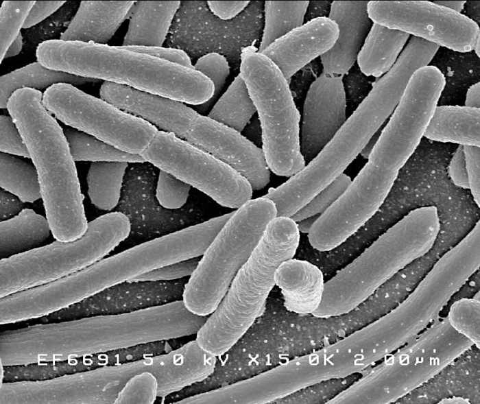 Escherichia coli, or E. coli, lives in our large intestine and is helpful. Some strains of E. coli are harmful, however.