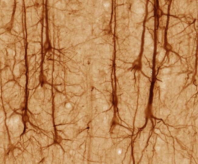These are brain neurons. Notice all the space between them. It's all flesh mixed with water. The water is necessary to separate the dendrons a bit, so they're not always charging us to action. (Hmmm. Wonder if that's a cause of ADHD?)