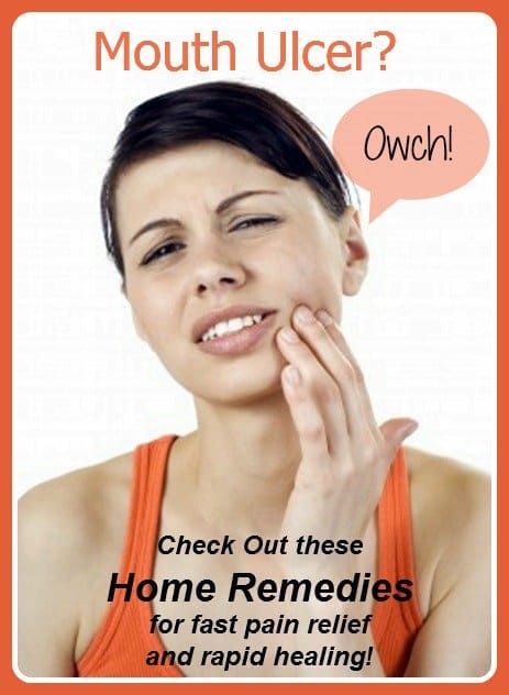 my home remedies have been tested by me to establish how effective they are at treating mouth ulcers