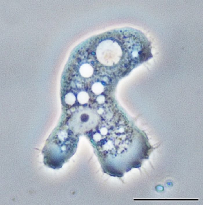 An Acanthamoeba trophozoite viewed under a phase contrast microscope