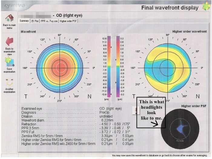 This is an image of my own Custom Wavefront LASIK evaluation. In the lower right corner you can see an image that shows the distortions caused by higher order aberrations. Essentially, when I look at headlights, this image is what I see.