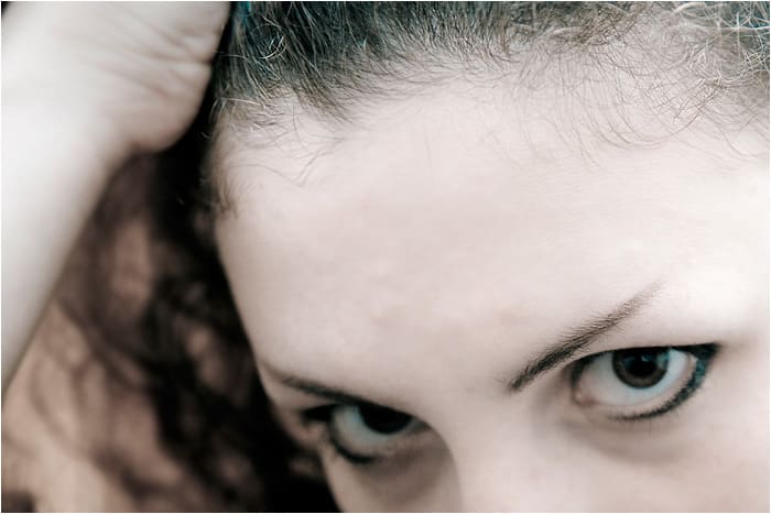 With the Mirena IUD, your hairline may recede or you may notice diffuse shedding all over your head.