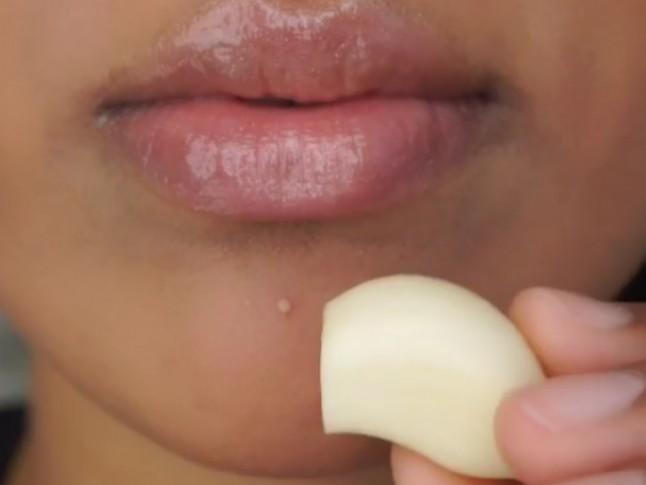 Garlic has antifungal and antibacterial properties, making it a potentially effective topical acne treatment option.