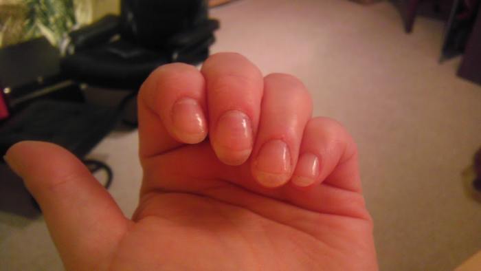 It took two full months, but I have nails now! I'm still battling with cuticles, but it looks like I'm finally winning.