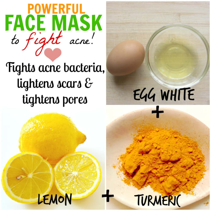 Egg whites are a popular home remedy for beautiful skin. Coupled with lemon, which lightens scars, and turmeric, which actively fights acne, this face mask is a powerful anti-acne remedy!