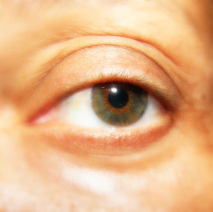 Author's natural eye. I started to lose my eyelashes due to illness. I really needed some help, as regular mascara did nothing.