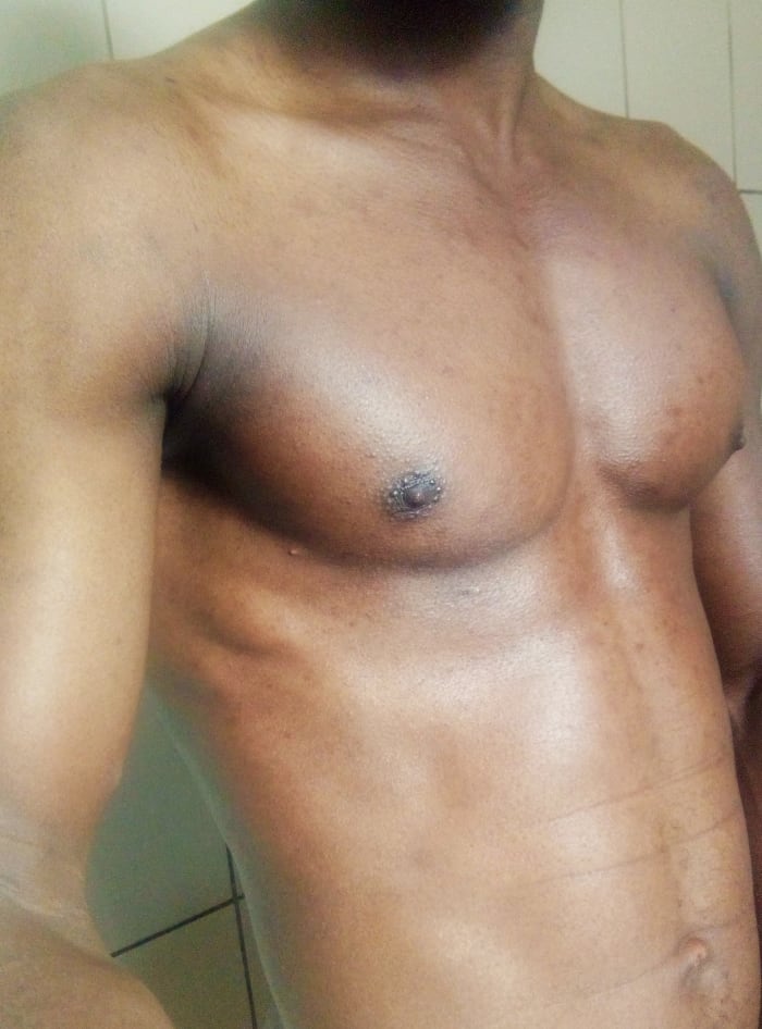 Apply a very thin layer of petroleum jelly on the whole body, to avoid the skin drying up. The skin should not appear shiny after applying the petroleum jelly. You can see that the scars seem to gradually disappear into my dark skin.