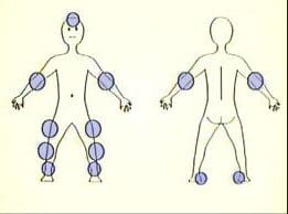 These are areas of normal, accidental bruising on a child. Bruises in these areas are common in children, and are not always indicative of abuse