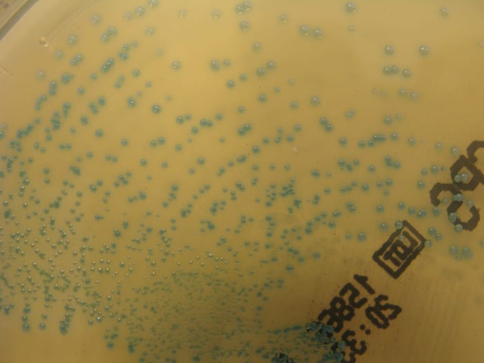 Group B Strep is a common bacteria - pregnant women will be screened for it in the third trimester and treated during labor, if necessary.