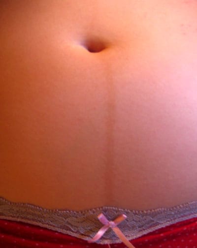 Una foto de linea nigra durante el embarazo. 