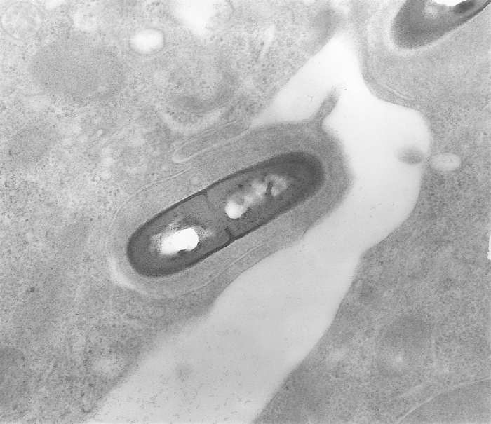 Listeria monocytogenes