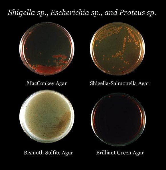 Four different types of agar plates showing differential growth depending on bacterial metabolism.