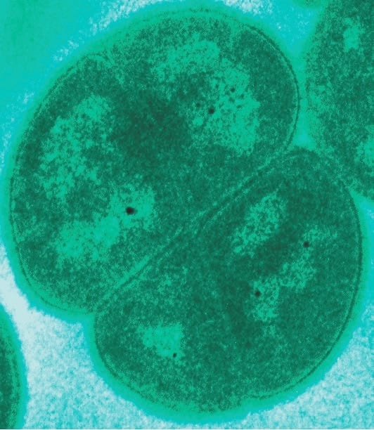 Deinococcus radiodurans in a tetrad form.