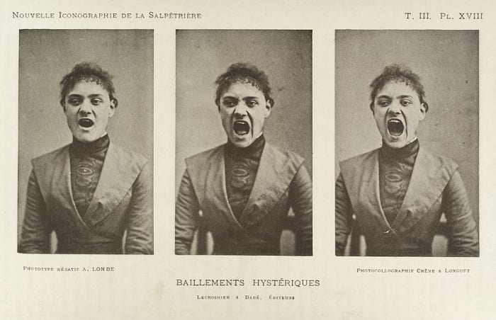 Hysteria is widely discussed in the medical literature of the Victorian era. In 1859, a physician claimed that a quarter of all women suffered from hysteria. He cataloged possible symptoms, which included faintness, nervousness, insomnia, fluid reten