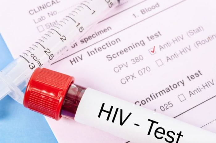 At present, millions of people have HIV/AIDS and they are now able to live normal lives thanks to modern treatments...although there is still no cure...