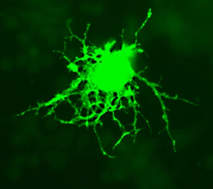 A green fluorescent protein has been added to this oligodendrocyte. Oligodendrocytes make myelin and are destroyed in multiple sclerosis.
