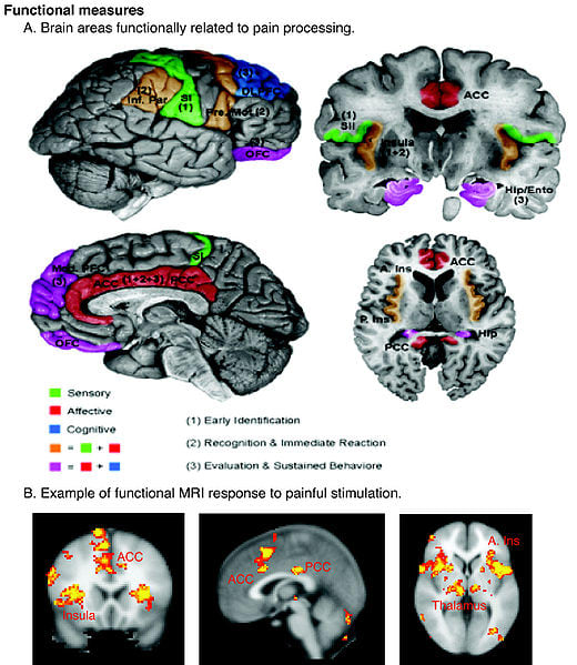 Our brain processes pain in different areas