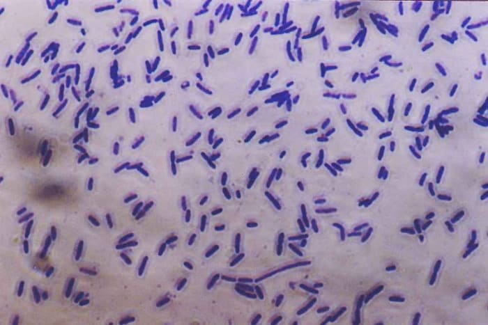 A photomicrograph of bacteria. The bacteria have been dyed purple to make them easier to see.