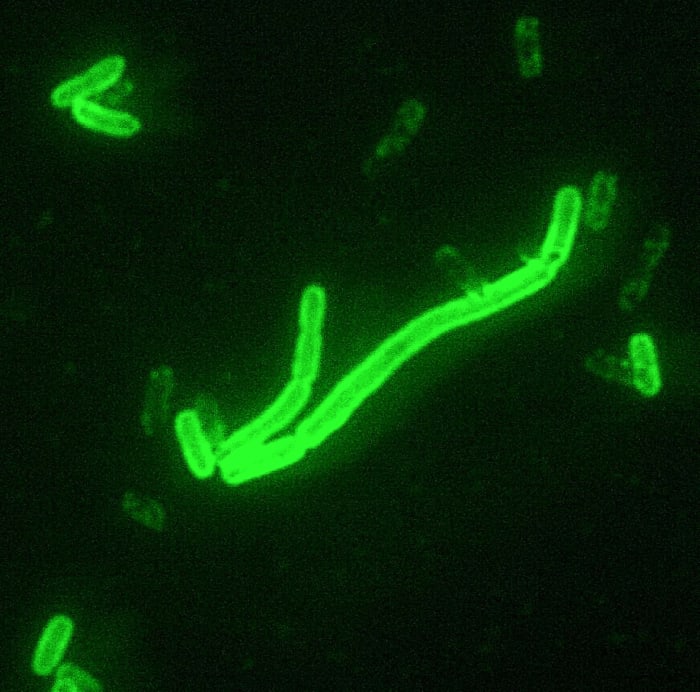 Yersinia pestis cells coloured by a fluorescent stain
