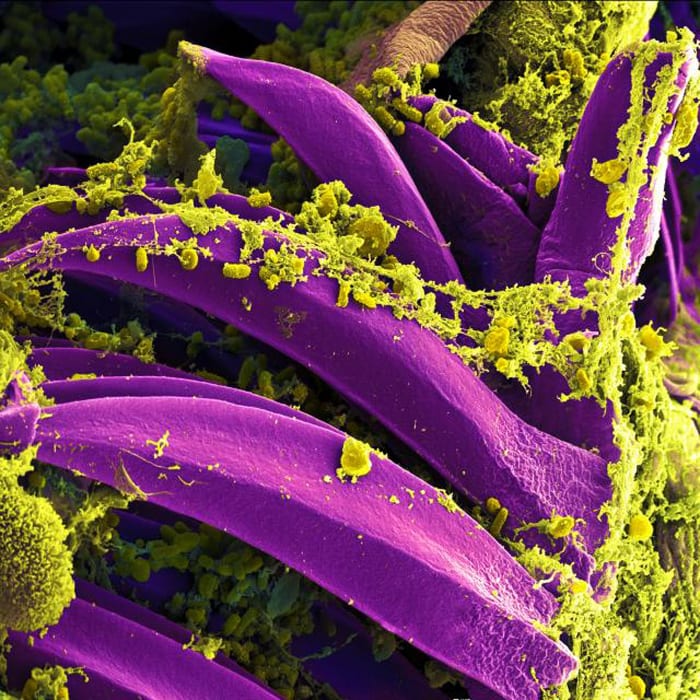 This colourized picture made with a scanning electron microscope shows Yersinia pestis (yellow) on the spines of the proventriculus, which is part of the fleas's digestive tract.