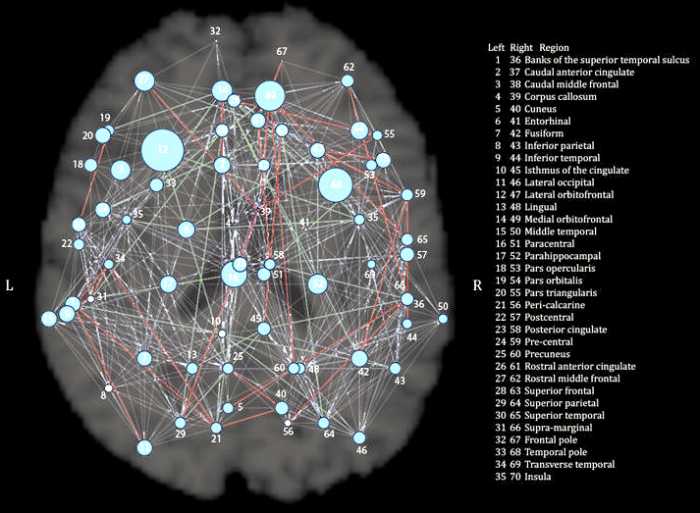 Genetic brain maps, in particular, can show whether we inherit patterns of brain structure from our parents, and if so, to what degree. We want to understand which parts of the brain are most strongly determined by our genes.