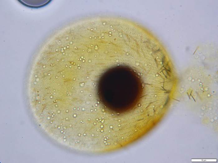The ciliate Prorodon has an extremely diverse diet, feeding on anything from algae to flagellates, ciliates and even microscopic worms