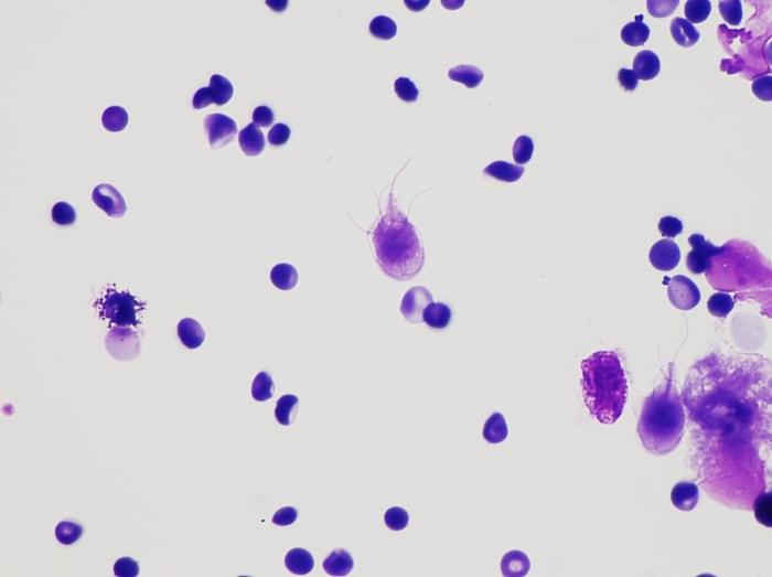A stained preparation of Giardia lamblia from a patient