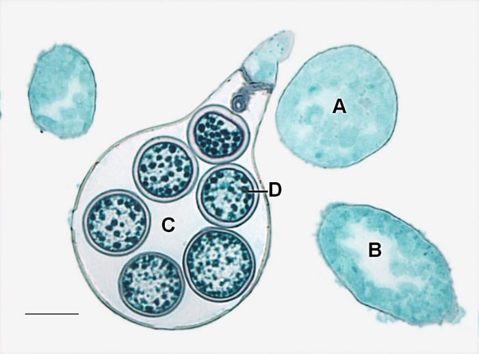 An oogonium containing oospheres