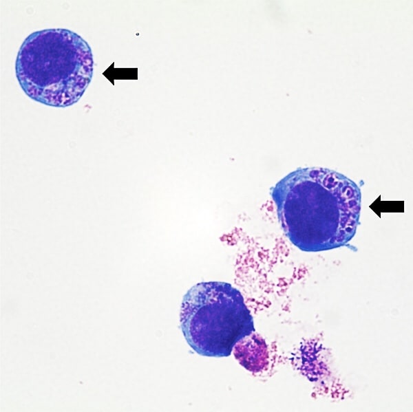 Anaplasma phagocytophilum in cultured white blood cells