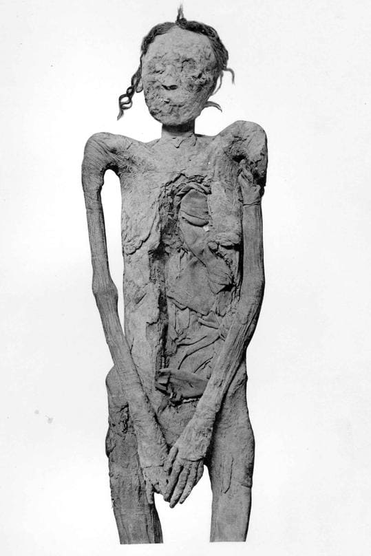 Mummy of Ahmose-Sitkamose, one of the Great Royal Wives of pharaoh Ahmose, found in DB320.