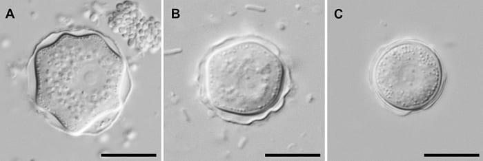 Acanthamoeba cysts in interference contrast microscopy