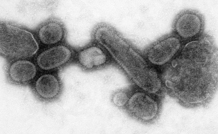 In 1918, viruses were yet to be discovered. This re-creation of the Spanish Flu virus was done much later and then recorded by an electron microscope.