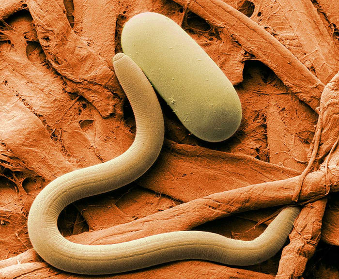 A soybean cyst nematode and an egg (colourized scanning electron micrograph)