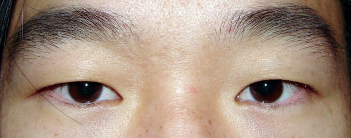 True black eyes do not exist, rather there are brown eyes so dark that it is hard to distinguish between the pupil and the iris in regular light.