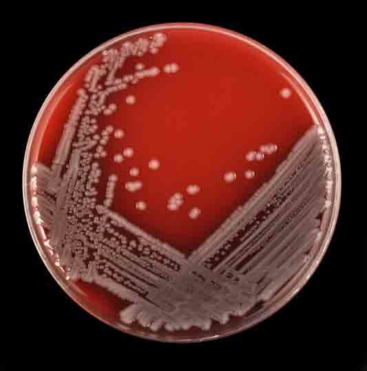 An example of what a microbiology plate looks like with bacteria growing on it. This one happens to be E.coli which is the most common cause of UTIs.